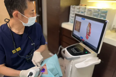 口腔内スキャナーで歯型を光学スキャンする様子
